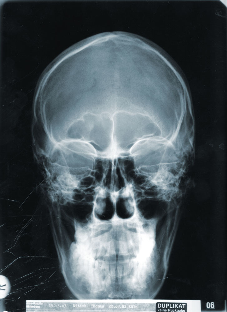 My head, x-rayed